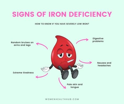 10 Hidden Signs of Iron Deficiency in Women Iron Deficiency Symptoms, Signs Of Iron Deficiency, Iron Supplements, Extreme Tiredness, Iron Absorption, Deficiency Symptoms, Brain Surgeon, Vitamin B12 Deficiency, Iron Deficiency