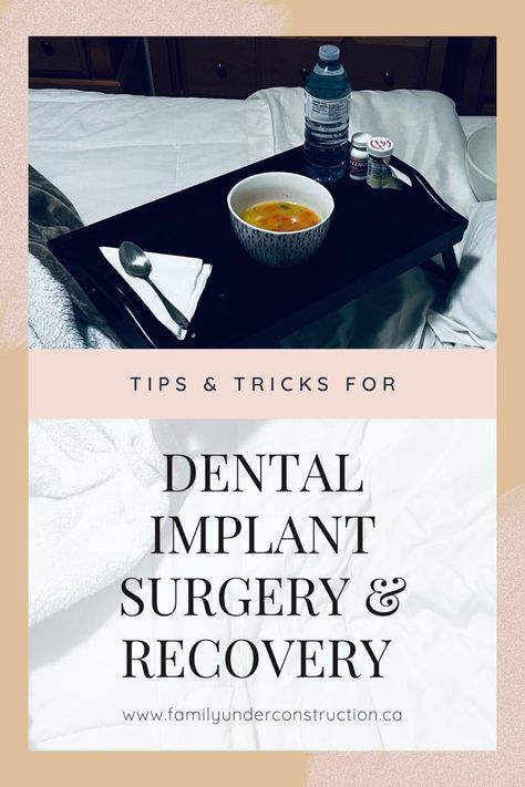 Are you currently going through the process of having dental implants, or are you considering it? Click here and learn about how my journey has been going. I provide tips on recovery and try to break the process down so that anyone considering having them, knows what to expect. #dentalimplant #dental #dentist #dentistry #dentalimplants #dentalcare #smile #teeth #oralsurgery #cosmeticdentistry #implantdentistry #teethwhitening #dentalhygienist #di #dentalhealth #dentalhygiene #dentalsurgery All On 4 Dental Implants, Full Liquid Diet, Tooth Implant, Dental Extraction, Dental Implant Procedure, Dental Decay, Best Toothpaste, Denture Implants, Dental Implant Surgery