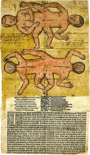 Broadside on conjoined twins born in Middleton Stoney on 3 August 1552 by Kintzertorium, via Flickr Siamese Twins, Human Oddities, Conjoined Twins, Mythical Monsters, Medical Aesthetic, Medical History, Dark Ages, British Museum, Letterpress