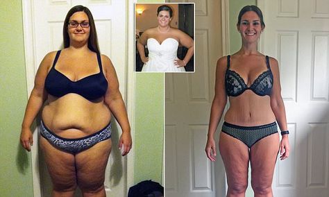 Obese woman drops HALF her body weight thanks to gastric band I Lost 100 Pounds, Garner Style, Gastric Band, Quick Fat Loss, Summer Diet, Kids Meal Plan, Slim Fast, Fat Loss Diet, Diet Vegetarian