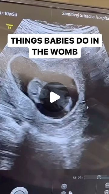 Dr Reema Ranka on Instagram: "“Garbhsanskar” literally means “shaping the fetus” or “education in the womb.”

Here is how our Garbhsanskar programe can help ypu -

1. *Emotional bonding*: Garbhsanskar helps create a strong emotional bond between the parents and the fetus, promoting a sense of connection and attachment.
2. *Fetal brain development*: Garbhsanskar practices like music, chanting, and storytelling stimulate the fetus’s brain development, enhancing cognitive skills and memory.
3. *Influence on personality*: Garbhsanskar believes that the fetus’s personality, temperament, and behavior can be shaped by the mother’s thoughts, emotions, and experiences during pregnancy.
4. *Moral values and ethics*: Garbhsanskar teaches the importance of instilling moral values and ethics in the fet Emotional Bonding, Personality Temperament, Gentle Exercise, Fetal Development, Baby Facts, Moral Values, Future Children, Brain Development, Future Kids