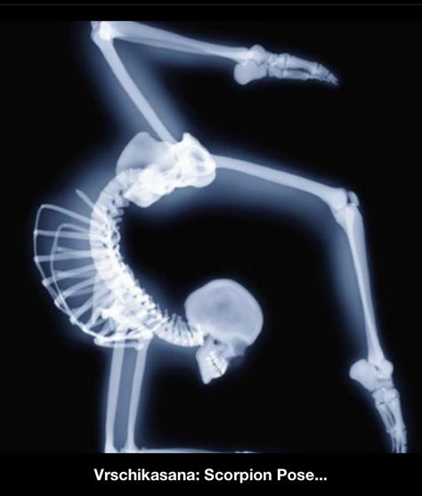 You are only as flexible as your spine. Scorpion Pose, Skeleton Girl, Arte Yoga, Wow Photo, Foto Art, Art And Illustration, Radiology, Human Anatomy, Skull And Bones