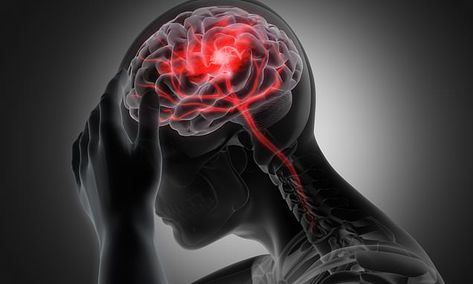 Headache Types, Head Pain, Magnetic Resonance Imaging, Chronic Migraines, Muscle Strain, Bad Posture, Tension Headache, Brain Damage, Signs And Symptoms