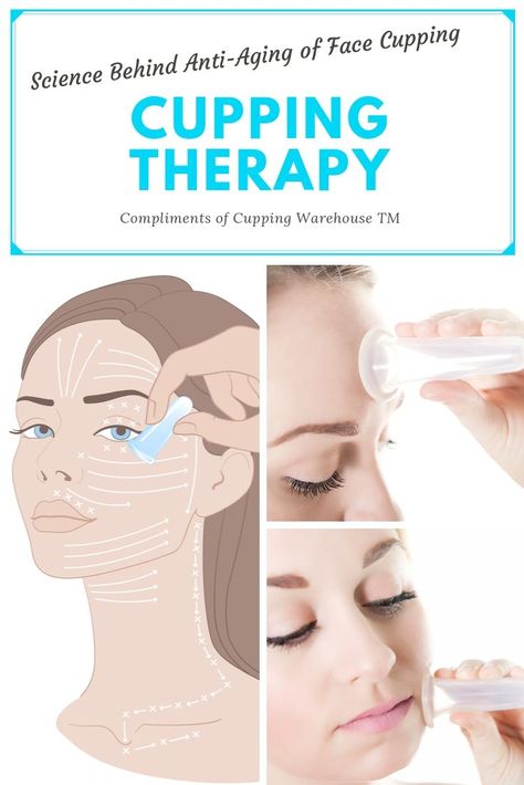 Face cupping, facial cupping, science behind facial cuping, anti-aging cupping, anti aging cupping, Face Mapping Acne, Facial Massage Routine, Cupping Massage, Facial Cupping, Face Mapping, Cupping Therapy, Acne Causes, Silicone Cups, Facial Exercises