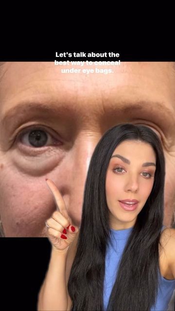 How To Hide Eye Bags With Makeup, Undereye Bags Makeup, Baggy Eyes Makeup, Eyebags Makeup, Confident Makeup, Eye Bags Makeup, Undereyes Bags, Under Eye Hollows, Baggy Eyes