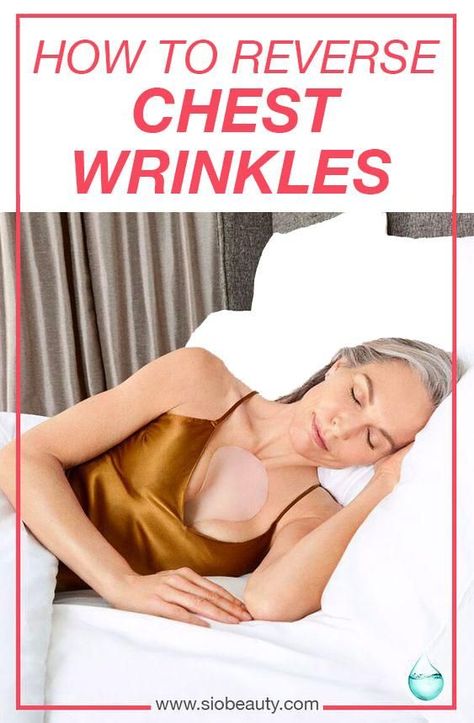 Antiaging remedies for chest wrinkles – Deep cleavage wrinkles, brown sun spots, thinning, red skin, and crepey skin, wrinkling on the upper chest can be prevented through a combination of awareness, self-care and treatments. #siobeauty #skincaretips #chestwrinkles #skincareproducts #howtobeauty #antiagingtips Skin Care Procedures, Chest Wrinkles, Anti Aging Remedies, Lotion For Oily Skin, Crepey Skin, Moisturizer For Oily Skin, Anti Aging Tips, Prevent Wrinkles, Best Anti Aging