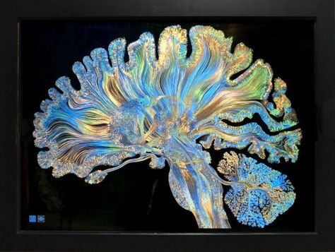 microetched-print – GREG DUNN NEURO ART Greg Dunn Neuro Art, Migraine Art, Biomimicry Architecture, Newsletter Layout, Alien Spacecraft, Bio Art, Medical Art, Create Animation, Ancient Aliens