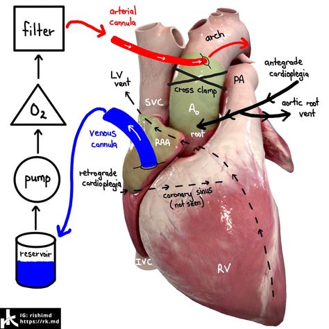 Cath Lab Nursing, Ultrasound School, Cardiothoracic Surgery, Nursing Fun, Vet Medicine, Nursing Student Tips, Cardiac Nursing, Critical Care Nursing, Nursing School Studying