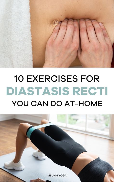 Fix your abdominal separation with these 10 diastasis recti exercises. This at-home workout for diastasis recti is perfect for postpartum fitness, with gentle yoga poses for diastasis recti repair! Workouts For Diastasis Recti, Workout For Diastasis Recti, Exercises For Diastasis Recti, Yoga For Knees, Diastasis Recti Repair, Easy Yoga For Beginners, Best Lower Ab Exercises, Postpartum Yoga, Pelvic Floor Muscle Exercise