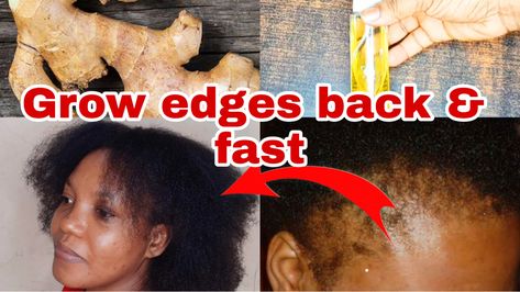 Diy Ginger Oil, Ginger Oil For Hair, Grow Edges, Edge Growth, Reduce Dandruff, Hair Grower, Fat Burning Cream, Fast Hair Growth, Yoga For Seniors