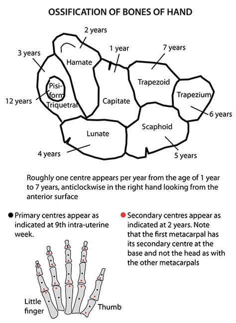 Carpal Bones Ossification: Mnemonic - https://epomedicine.com/medical-students/carpal-bones-ossification-mnemonic/ Carpal Bones, Anatomy Of The Body, Radiology Schools, Medical Terminology Study, Radiology Student, Radiology Imaging, Anatomy Bones, Physical Therapy Assistant, Basic Anatomy And Physiology