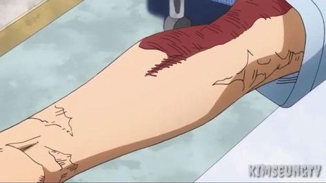 Scar Tattoo, Tv Time, Tv Times, Anime Tattoos, Upside Down, Tattoo Drawings, Boku No Hero Academia, Attack On Titan, My Hero Academia