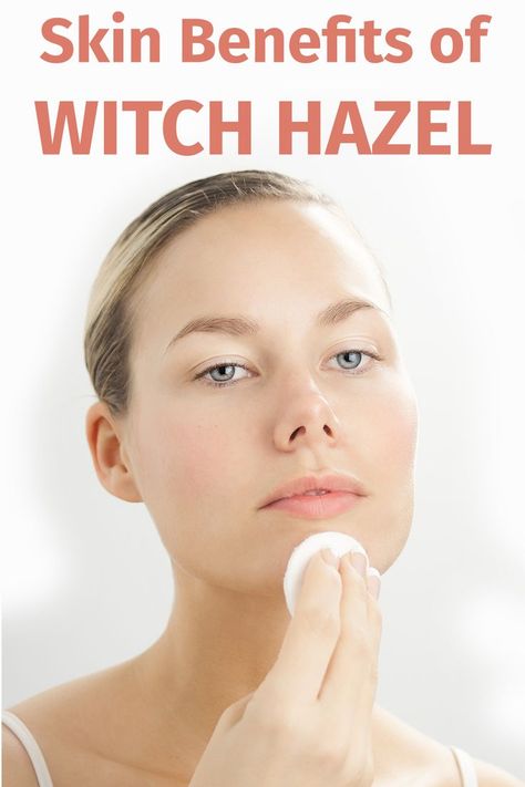 Witch hazel can be a useful topical remedy for the following skin and hair problems. Benefits Of Witch Hazel On Face, Witch Hazel Skin Benefits, Witch Hazel Uses Skin Care Benefits, Which Hazel Benefits, Witch Hazel Uses Skin Care, Dog Itchy Skin Remedy, Witch Hazel Benefits, Benefits Of Witch Hazel, Itchy Skin Remedy