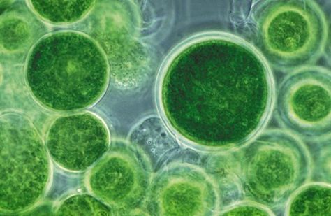 cyanobacteria Under The Microscope, Blue Green Algae, Fish Feed, Green Superfood, Yoga Sequence, Green Algae, Chair Yoga, Juicing For Health, Yoga Teachers