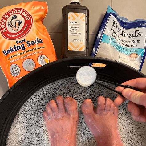 Discover How This 3-Minute Shower Soak Routine Got Rid of Toe-Nail Fungus Fast Toenail Fungus Soak, Foot Fungus Remedies, Diy Foot Soak, Nail Remedies, Foot Soak Recipe, Toenail Fungus Remedies, Nail Fungus Remedy, Fungal Nail, Ingrown Toe Nail