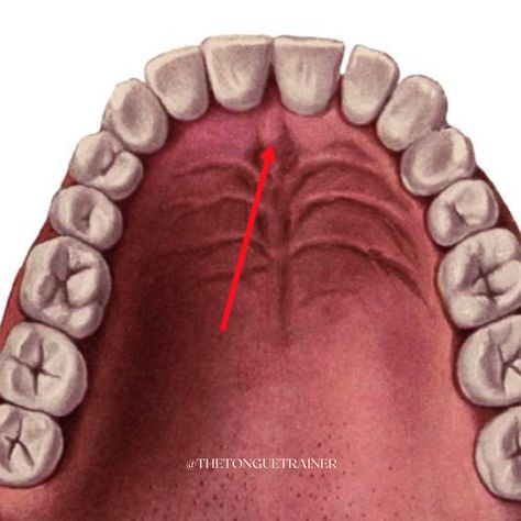 Why does correct tongue posture matter? Orofacial Myofunctional Therapy, Tongue Posture, Tongue Thrust, Myofunctional Therapy, Mouth Breathing, The Vagus Nerve, Crooked Teeth, Jaw Pain, Bone Structure