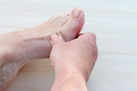 Gout symptoms—foot pain, especially—should not be left untreated because it can cause damage to your joints. http://universityhealthnews.com/daily/bones-joints/gout-symptoms-foot-pain-especially-in-your-big-toe-is-a-sign/ Big Toe Pain, Neurology Nursing, Country Wedding Pictures, Homemade Body Care, Foot Exercises, Uric Acid, Neurological Disorders, Evening Primrose Oil, Nerve Pain