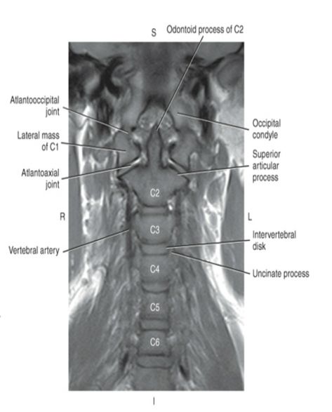 Mri Anatomy, Radiology Student, Anatomy Bones, Cute Scrubs, Cervical Spine, Radiology, Head And Neck, Anatomy, Bones