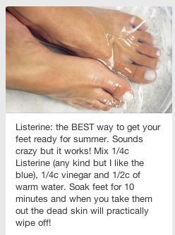 Dry Cracked Heels, Home Health Remedies, Cracked Heels, Beauty Remedies, Beauty Skin Care Routine, Health And Beauty Tips, Beauty Treatments, Beauty Secrets, Diy Beauty