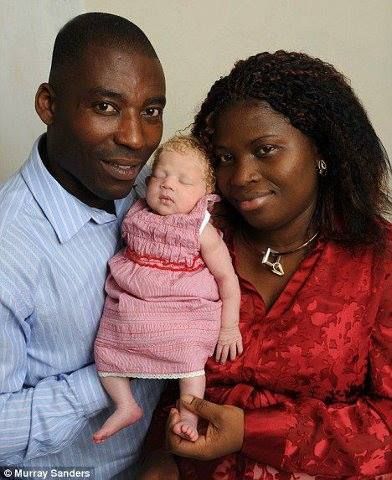 Angela Ihegboro Is From Nigeria Who Gave Birth To Baby Nmachi Who Is White And Blond Headed. All civilization started from the very 2 people Jehovah God created and placed them in the Garden Of Eden. Medical Anomalies, Physical Anthropology, African Room, Human Genetics, Genesis 25, Richard Johnson, Paddy Kelly, John Charles, Black Family