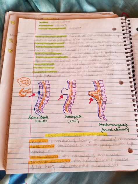 Neural tube notes Medical Sonography, Diagnostic Medical Sonography, Ultrasound Tech, Spina Bifida, Physician Assistant, Ultrasound, School Stuff, Medical, Education