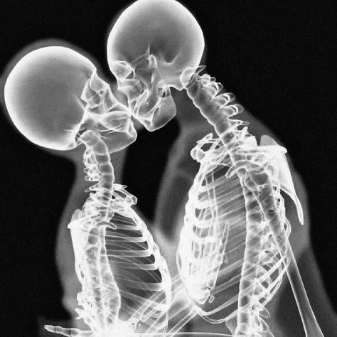 ORIVGINAL on Instagram: “skeleton love ☠️” Skeleton, Black And White, On Instagram, White, Instagram, Black