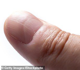 What your NAILS say about your health, according to an expert | Daily Mail Online Nail Health Chart, Nail Health Signs, Diseases And Disorders, Healthy Cuticles, Different Color Nails, Nail Care Diy, Nail Conditions, Antifungal Cream, Uk Nails