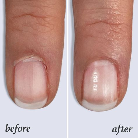 more in telegram Cuticles Before And After, Before After Nails, Manicure Before And After, Perfect Cuticles, Skincare Content, Nail Cuticle Oil, Dry Cuticles, Diy Beauty Treatments, Nail Salon Design