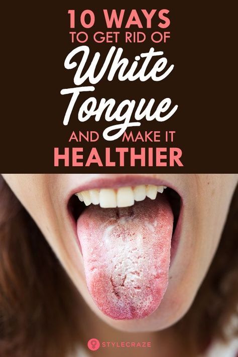 Natural Antifungal, White Tongue, Poor Digestion, Health Signs, Tongue Health, Nail Health, Fitness Planner, Tooth Decay, Oral Hygiene