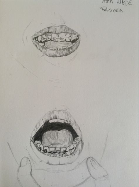 When I first got braces. Draw a man made pattern = braces, summer 2013 brief also Braces Mouth Drawing, Teeth With Braces Drawing, Mouth With Braces Drawing, How To Draw A Smile With Teeth, How To Draw Braces, Braces Drawing Reference, Drawing Braces, Lips With Braces, Mouth With Braces