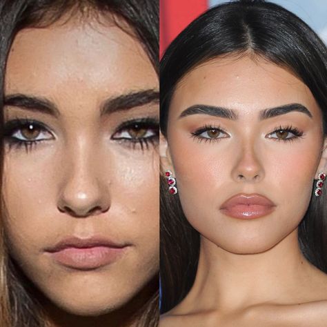 Madison Beer plastic surgery Madison Beer Plastic Surgery, Eyebrow Lift Surgery, Botox Lip Flip, Filler Face, Face Plastic Surgery, Foxy Eye, Lip Flip, Botox Brow Lift, Cheek Implants