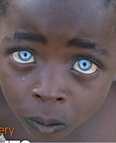 Acting White Acting Black: Blue Eyes, Blacks And Occular Albinism Waardenburg Syndrome, Black With Blue Eyes, People With Blue Eyes, Wolf Eyes, Charming Eyes, Amazing Eyes, Black Hair Blue Eyes, Eyes Beautiful, Windows To The Soul