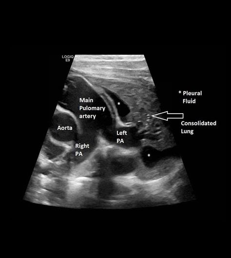 Pediatric Cardiac Sonography, Diagnostic Medical Sonography Student, Acute Care Nurse Practitioner, Cardiac Sonography, Sonography Student, Vascular Ultrasound, Medical Sonography, Ultrasound Sonography, Radiology Student