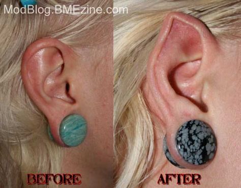 I think Samppa Von Cyborg does wonderful ear pointing. His technique is AMAZING and has the best result I've seen. Ear Pointing, Dermal Implants, Pixie Ears, Pointed Ears, Elf Ears, Body Modification, Some Body, Body Piercings, Thought Process