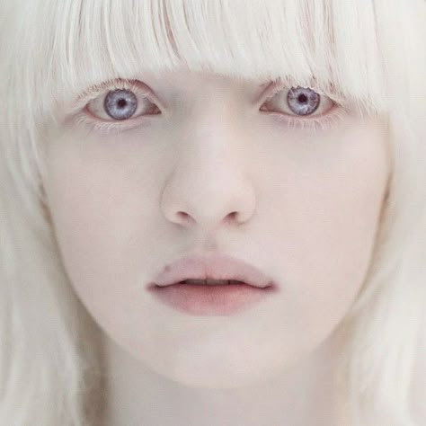 Axis Layla Fey - A natural albino, has difficulty seeing in bright light and is easily sunburned.  She is lovely, such a beautiful face. Nastya Zhidkova, Albino People, Albino Model, Albino Girl, Pastel Decor, Purple Eyes, People Of The World, Pale Skin, Interesting Faces