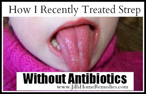 Jill's Home Remedies: How I Recently Treated Strep Without Antibiotics Strep Throat Pictures, Signs Of Strep Throat, Strep Throat Remedies, Throat Remedies, Strep Throat, Homemade Laundry, Oral Hygiene, Emergency Preparedness, Health And Wellbeing