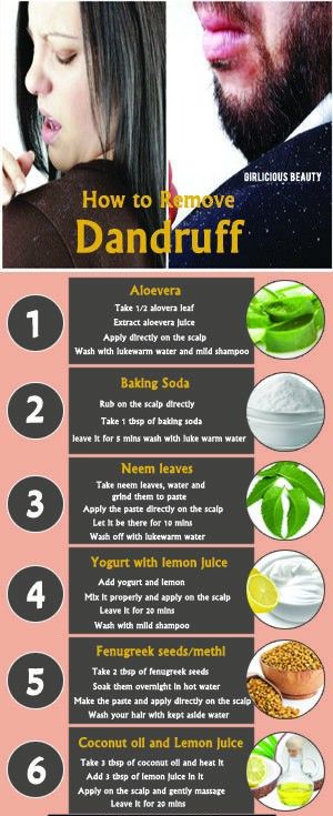 remove dandruff tips Hair Fall Control Tips, How To Remove Dandruff, Hair Mask For Dandruff, Facial Routine Skincare, Homemade Hair Treatments, Dandruff Remedy, Hair Care Remedies, Flaking Skin, Clear Healthy Skin