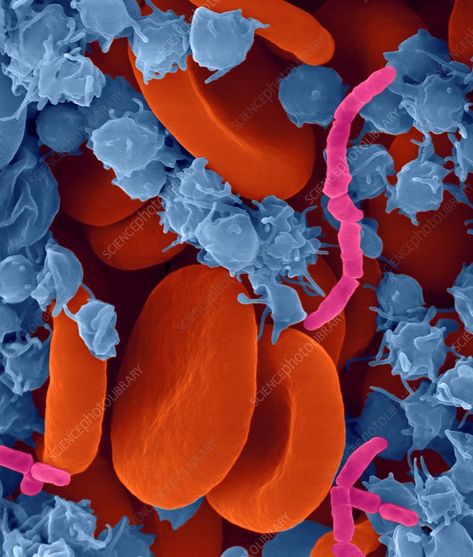 Blood Infection, Septic Shock, Scanning Electron Micrograph, Microscopic Photography, Science Photos, Body Tissues, Red Blood, Circulatory System, Red Blood Cells