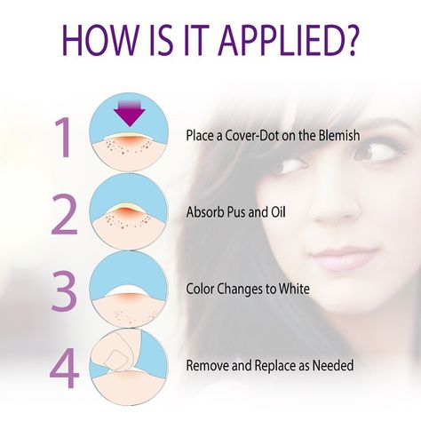 Easy as 1-2-3-4! Hide and heal with Cover-Dot #skincare #acnecure Acne Patches, Forehead Acne, Acne Care, Scarring, Skin Remedies, Fitness Beauty, Facial Care, Beauty Secrets, Skin Health