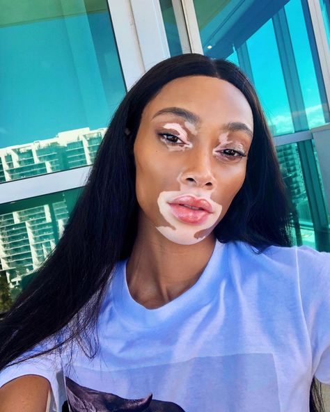 ♔Winnie Harlow♔ on Instagram: “Remember you’re just as beautiful without makeup as you are with it 💙🦋🐬” Winnie Harlow Aesthetic, Grunge Vintage Aesthetic, Winnie Harlow Instagram, Chantelle Brown Young, E Girl Hair, Olive Complexion, Egirl Style, Egirl Makeup, Maybelline Lipstick