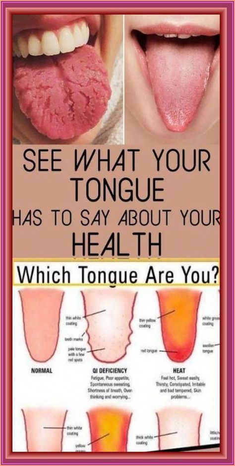 What Your Tongue is Trying to Tell You About Your Health #tongue Tongue Health, Tongue Cleaner, Feeling Hot, Dull Hair, Shortness Of Breath, Body Organs, Medical Problems, Digestive System, What’s Going On