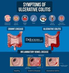 Ulcer Symptoms, Gastric Problem, Gut Health Diet, Autoimmune Diet, Inflammatory Bowel, Disease Symptoms, Gut Microbiota, Give Hope, Gourmet Cooking