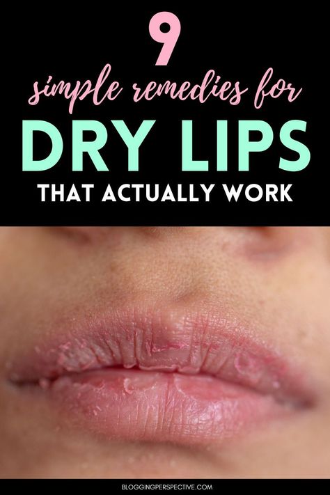 Step up your lip care routine with our professional advice! Find out how simple adjustments can fix your dry lips and prevent chapped lips. For plump lips that feel as good as they look, check out our full guide on the blog! How To Stop Lips From Peeling, Dry Lips Remedy Diy, Severely Chapped Lips Remedy, Dry Chapped Lips Remedy, Best Lip Care Routine, How To Get Rid Of Dry Lips Fast, Dry Cracked Lips Remedy, Peeling Lips Remedies, Remedy For Dry Lips