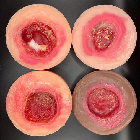 SET (4 pieces): Pressure Injury Models for Wound Care Education. Includes 2 pieces of stage 3 pressure injuries and 2 pieces of stage 4 pressure injuries. Tissue Types, Medical Grade Silicone, Wound Care, Wound Healing, Education, 10 Things