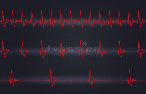 Fast Normal Slow Heartbeat Illustration. Medicine illustration of heart pulsatin #Sponsored , #paid, #Ad, #Slow, #Fast, #heart, #Heartbeat Heartbeat Illustration, Hart Beat, Medicine Illustration, Fast Heartbeat, Health Disease, Cardiology, Watercolor Brushes, How To Slim Down, In A Heartbeat