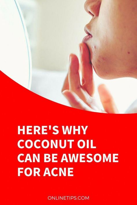 Here Is How To Look Years Younger - By Using Coconut Oil by Hannah Sanderson | This newsletter was created with Smore, an online tool for creating beautiful newsletters for educators, nonprofits, businesses and more Coconut Oil Remedies, Face Care Acne, Coconut Oil Face Mask, Coconut Oil Beauty, Face Cream For Wrinkles, Diy Coconut Oil, Coconut Oil For Acne, Coconut Oil For Face, Benefits Of Coconut Oil