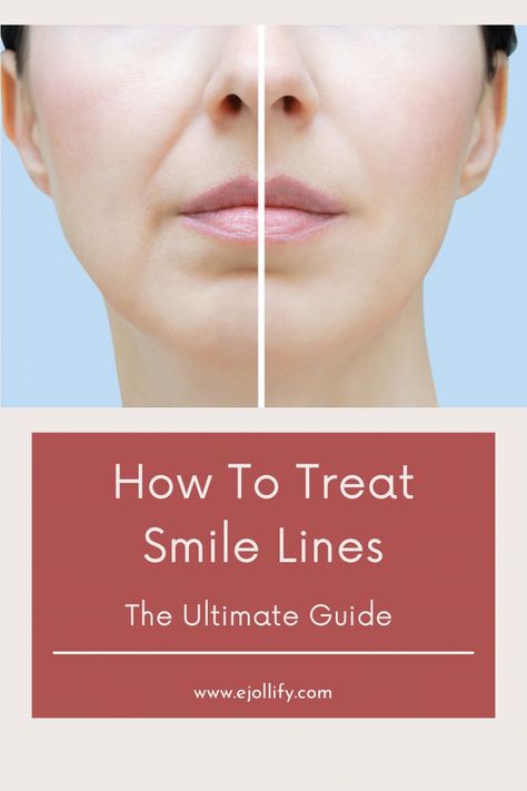 How To Get Rid of Smile Lines • Treatments & Skincare Best Products For Smile Lines, Facial Lines Around Mouth, Lines Around Mouth How To Get Rid, Getting Rid Of Frown Lines, Fine Lines Around Mouth, Reduce Laugh Lines, Filler Around Mouth, Filler For Nasolabial Folds, Filler Nasolabial Folds