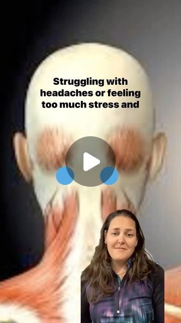 Julie • Movement & Life Coach on Instagram: "Headache relief and vagal reset   @fitomizefitness   These two points at the base of your skull can offer you some headache relief and give you a vagal break or reset.   This point is known as GB 20. The point is located at the top of the sternocleidomastoid muscle which runs from the back of the head down to the front of the shoulders at the clavicle.   Stimulation of this point will help relieve a headache, neck pain and shoulder tension.  And, if you follow the gallbladder channel further down it’s pathway you’ll see that tension at this point is also related to low back pain, hip pain, and lateral leg pain.  It’s really easy to apply pressure to Gallbladder 20 by grasping your own head and allowing your thumbs to fall into the point. Slight Tension Headache Relief Remedies, Headache Relief Pressure Points, Headache Back Of Head, Head Pain Relief, Tension Headache Relief, Sternocleidomastoid Muscle, Forward Head Posture Exercises, Headache Relief Instant, Shoulder Stretches