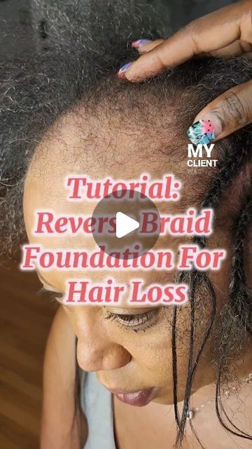 7,259 likes, 71 comments - mane_event_beauty_llc on May 8, 2024: "💌Tutorial: Reverse Braid Foundation For Hair Loss. Follow To See New Tutorials. Call or text 301-485-9298 Traveling Stylist Serving DC...". hair loss, reverse braids, cornrowing, beehive braid, crochet Braids To Protect Edges, Foundation For Crochet Braids, Crochet Braid Pattern For Thinning Hair, Protective Styles For Thinning Edges Natural Hair, Styling Crochet Braids, Hairline Protective Hairstyles, Braids For Thinning Edges, Braids For Thinning Hair, Braiding Pattern For Crochet Braids