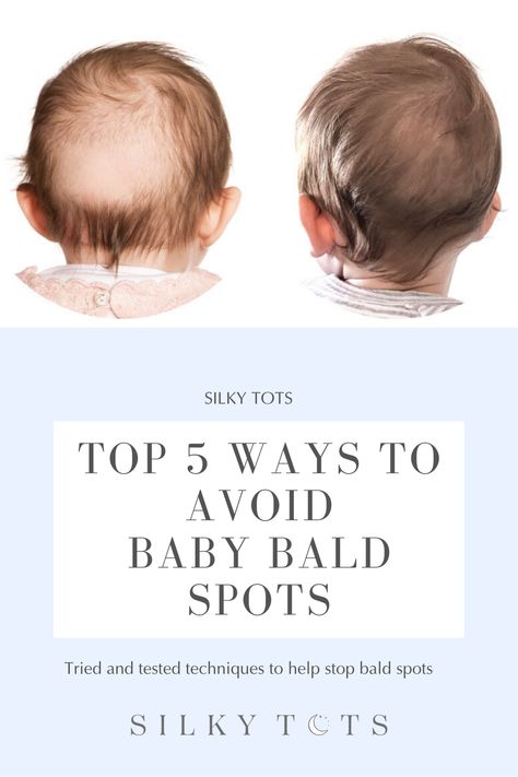 The Leading cause for baby bald spots on the back of their head is friction caused by lying on their backs for long periods of time. We have put together some tried and tested techniques to help your baby retain their hair and keep it healthy, silky & smooth while you're at it! Baby Bald Spot Tips, Newborn Hair Care, Baby Losing Hair, Baby Boy Hair, Baby Head Shape, Newborn Hair, Baby Essentials Newborn, Newborn Baby Care, Newborn Baby Tips